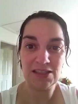 Immediate Dentures: hard reline