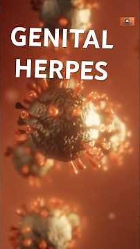 Understanding Genital Herpes Causes Symptoms and T1