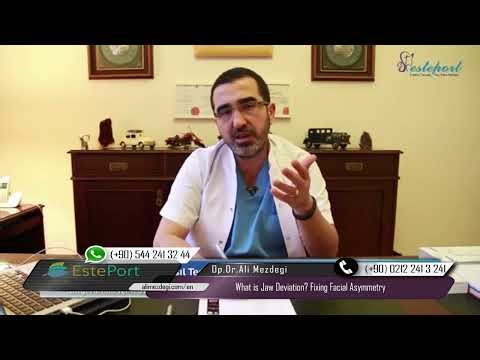 What is Jaw Deviation? Fixing Facial Asymmetry | Dr. Ali Mezdeği