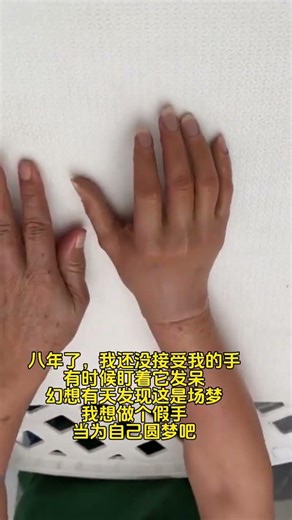 Wearing it looks very realistic. \n#FakeFingers #AestheticSiliconeFingers #TrendingNow