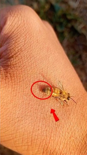 What Really Happens When You Get Stung? 🐝😱