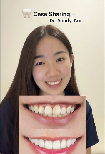 Smile Transformation Journey: Behind the Smile Series EP1