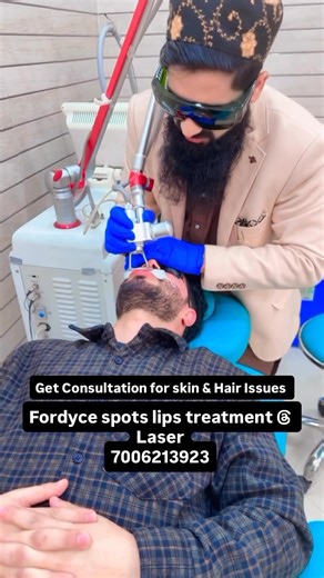 fordyce spots lips treatment by laser at Dr Baigs Clinic 7006213923 Dr baigs clinic allochibagh gulshan colony near mintocircle school and masjid tyyib monday tuesday friday 2pm to 4pm 9797794193 https://maps.app.goo.gl/Rvre3QdvVP6uHf4w7?g_st=ic ::: Dr Baigs face and hair clinic nowgam wanbal shankarpora near police station nowgam 9797794193 monday tuesday friday 6pm to 7:30pm https:/maps.app.goo.gl/hgHtgUZCouxAxgPM6?g_st=ic ::: Dr baigs clinic bemina shah e hamdaan colony near power grid statio