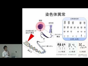 骨髄異形成症候群・急性骨髄性白血病 内田 直之