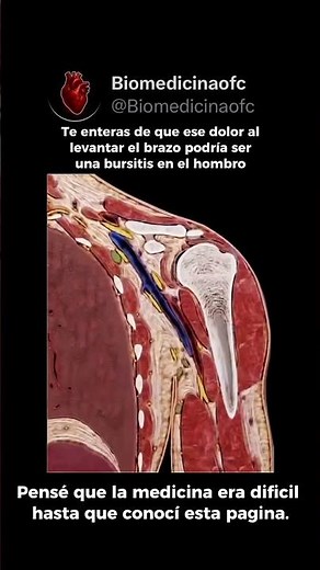⚠️ ¿DOLOR AL MOVER EL BRAZO? LA CIENCIA DETRÁS DE LA BURSITIS 🧬