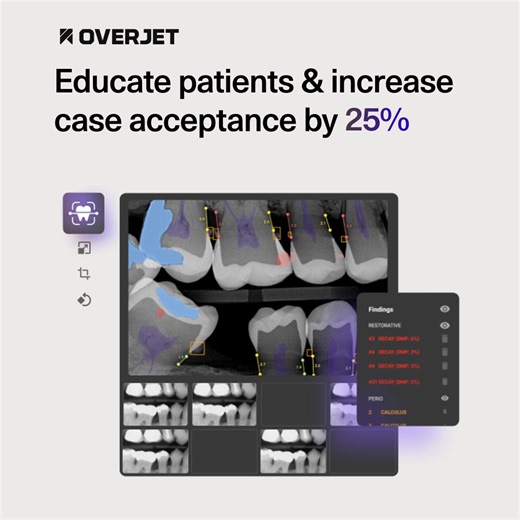 AI in dentistry is the new standard for care. Just see what our clients say: “Overjet is like dentistry on steroids. It helps us detect missed diagnoses, integrate providers, follow higher standards for quality care, and also make sure our providers are giving excellent oral health solutions ensuring our patients get to keep their natural teeth for life.” See how it works. 👇 | Overjet