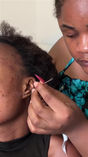 ASMR Ear Nitpicking and Cleaning for Relaxation