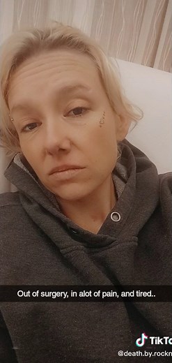 laparoscopic bilateral salpingectomy surgery yesterday..