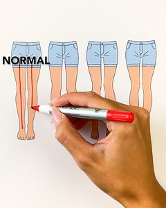 996K views · 1.3K reactions | Understanding leg anatomy and vector knees例 | Handy Dandy | Facebook