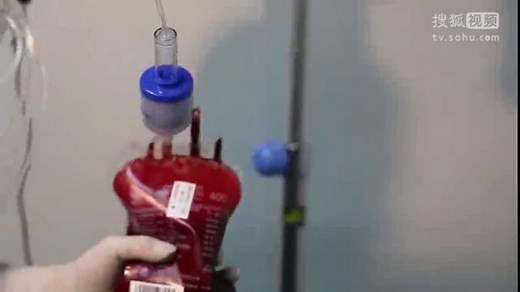 血液过滤器的使用方法