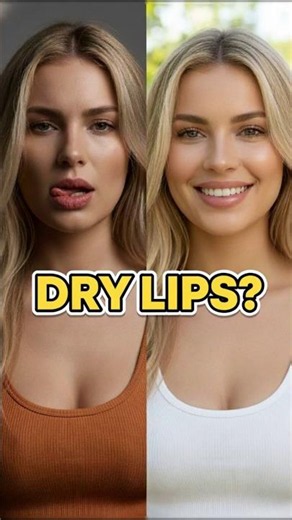 Licking Your Lips Is Making Them Worse