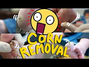 Satisfying Massive CORN Removal Compilation! BE AMAZED!