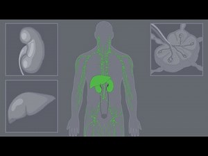 How can TCE affect your health? - Cancer