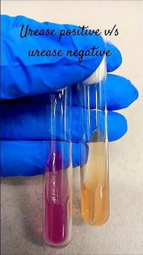 urease positive v/s urease negative #microbiology #bacterialculturemedia #infection #lablife