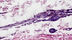 400x Magnification Simple Squamous Epithelium Filmed Stock Footage Video (100% Royalty-free) 1107341207 | Shutterstock