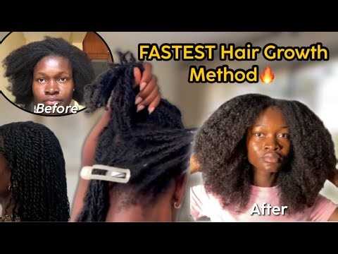 I’M SHOCKED !! 😮 The Fastest Hair Growth method Using Mini Twists | 4C Hair