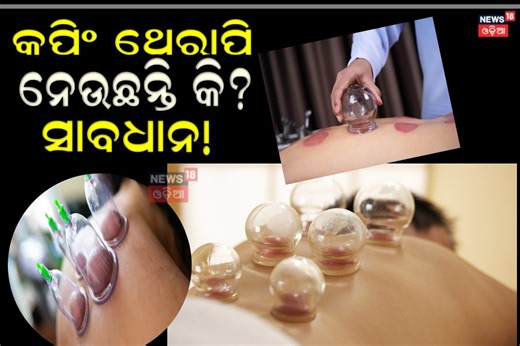 Cupping Therapy Side Effects: କପିଂ ଥେରାପି ନେଉଛନ୍ତି କି? ଜାଣିନିଅନ୍ତୁ ଏହି ଥେରାପିର ଅସଲ କଥା..