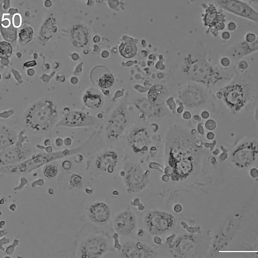 Nonshrinkable Thermosensitive Hydrogels for Tumor Immunotherapy – Video S2B [496746]