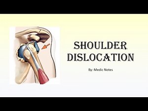 [Ortho] Shoulder dislocation - anterior vs posterior, x-ray signs, management, Hippocrates & Kocher