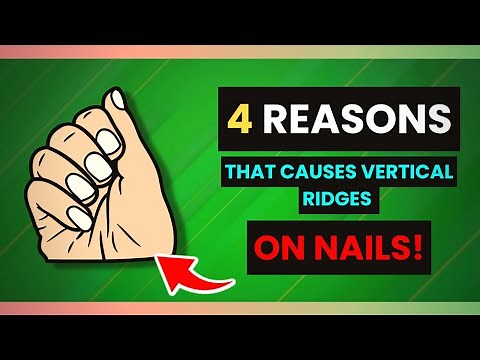 4 Signs and Symptoms of Why Vertical Ridges are Caused in your Nails!