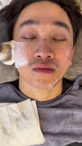Sweet girls are more attractive.#解压 #asmr #黑头 #shave | facial asmr relaxing