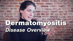 9.2K views · 116 reactions | Dermatomyositis is a rare autoimmune...