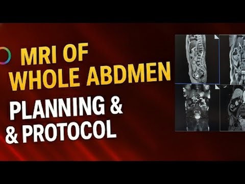 How to Perform Whole Abdomen MRI | Complete Positioning & Sequences