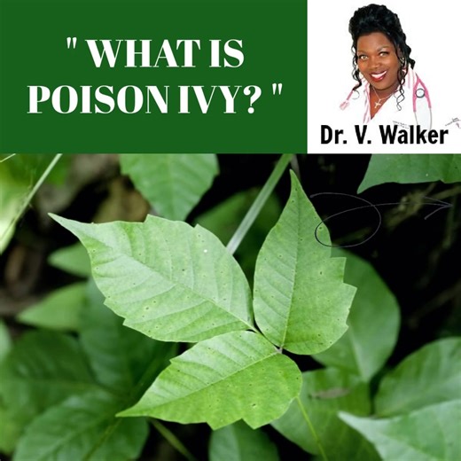 " WHAT IS POISON IVY? " Poison ivy, poison oak, and poison sumac are all plants that can cause a temporary, irritating rash when they come in contact with your skin. This rash is a form of allergic contact dermatitis. Dermatitis simply means an irritation of the skin. It's called "allergic contact dermatitis" because the rash is caused by contact with a substance to which you're allergic. #drvaleriewalker #health | Dr. Valerie Walker