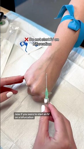 Bifurcation of the Vein #RN #BSN #nursehumor