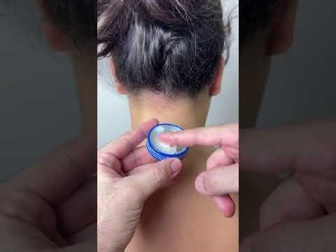 You Didn’t Know This Hidden Use of Vicks VapoRub! 😱🔥 | #shorts