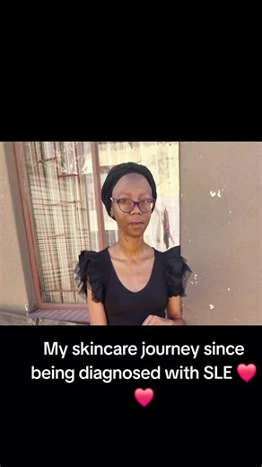 My Skincare Journey with Lupus: Real Progress & Tips