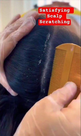Satisfying Scalp Scratching 🤤😌 #scalpscratching #scalpcare #scalpdandruff ‪@CelainesASMR‬