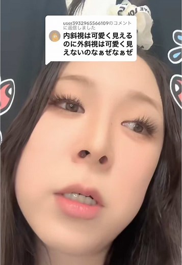 内斜視の可愛い魅力とアイドルたち