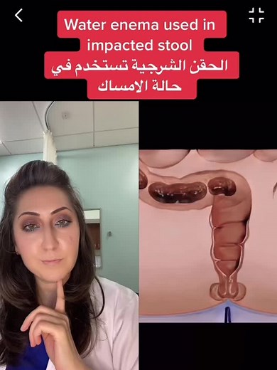 Effective Enemas for Constipation Relief Techniques