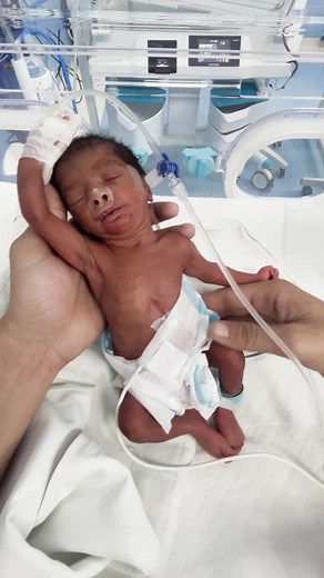 35K views · 826 reactions | #cutebaby #baby #babyfirstbreath #cute | Born Cute Babies | Facebook