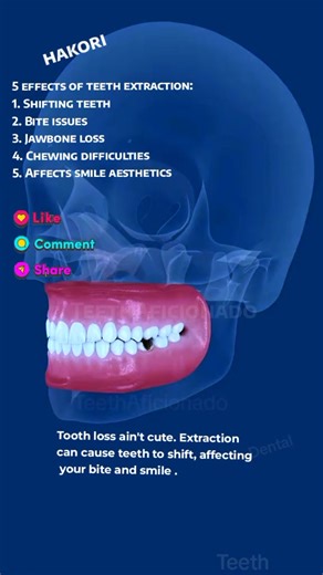 Understanding the Hidden Costs of Teeth Extraction
