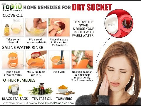 Dry Socket 6 Effective Home Remedies For Dry Socket 6 Natural Cures For Dry Socket