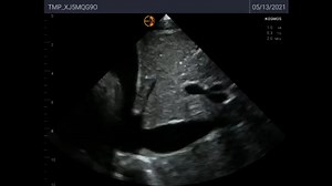 Products- Kosmos Ultrasound- Torso One (2)