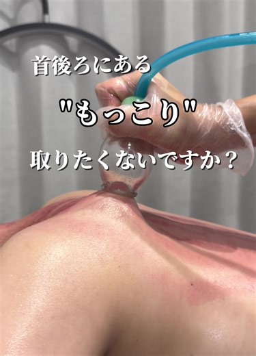 首・肩まわりの凝りを改善する方法