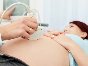 Nuchal translucency (NT) scan