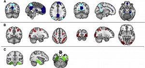 Examining the ancient technique of "memory palaces" with brain-imaging