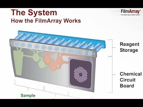 Focus on FilmArray® - CAP TODAY Webinar