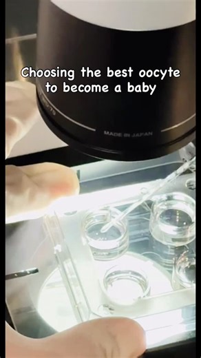 Embryologist Putri on Instagram: "During oocyte pick-up (OPU), follicular fluid is carefully collected and examined to identify oocytes. The retrieved oocytes then undergo denudation, where surrounding cumulus cells are gently removed to assess oocyte maturity and quality. This step is essential to determine suitability for fertilization and optimize IVF outcomes #ivf #ivfsuccess #ivfjourney #embryologist #lab"