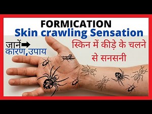 Formication|Skin crawling sensation|Reason & Home remedy|स्किन में कीड़े चलने जैसी सनसनी|घरेलू उपाय