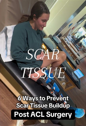 6 Ways to Prevent Scar Tissue Buildup After ACL Surgery