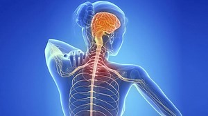 ¿Qué es la Esclerosis Múltiple? -  Salud FacMed