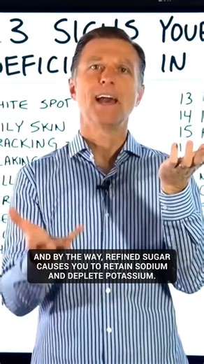 55K views · 951 reactions | WHAT IS PITTING EDEMA & HOW TO HANDLE IT?  #DrEricBerg TIPS Learn what pitting edema is, its causes, and effective ways to manage it naturally with potassium and lifestyle changes. #PittingEdema #DrEricBerg #Potassium #HealthTips #WellnessJourney #LittleMissDiagnosed #FluidRetention #NaturalHealing #FunctionalMedicine #SelfCare | Diet & healthy By Dr | Facebook