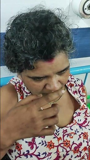 Past pointing in cerebellar lesion. #neurology #medical #clinical