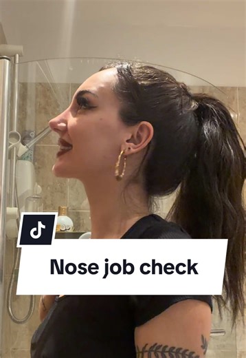 Nose Job Transformation: Before and After Reveal