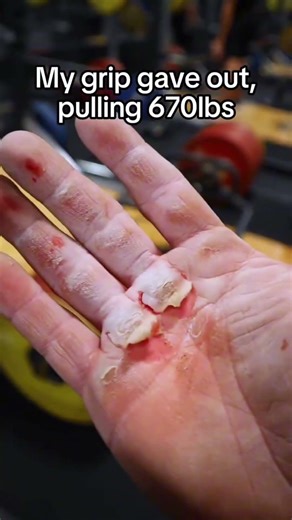 Gym accident gone wrong! 🤕 #shorts